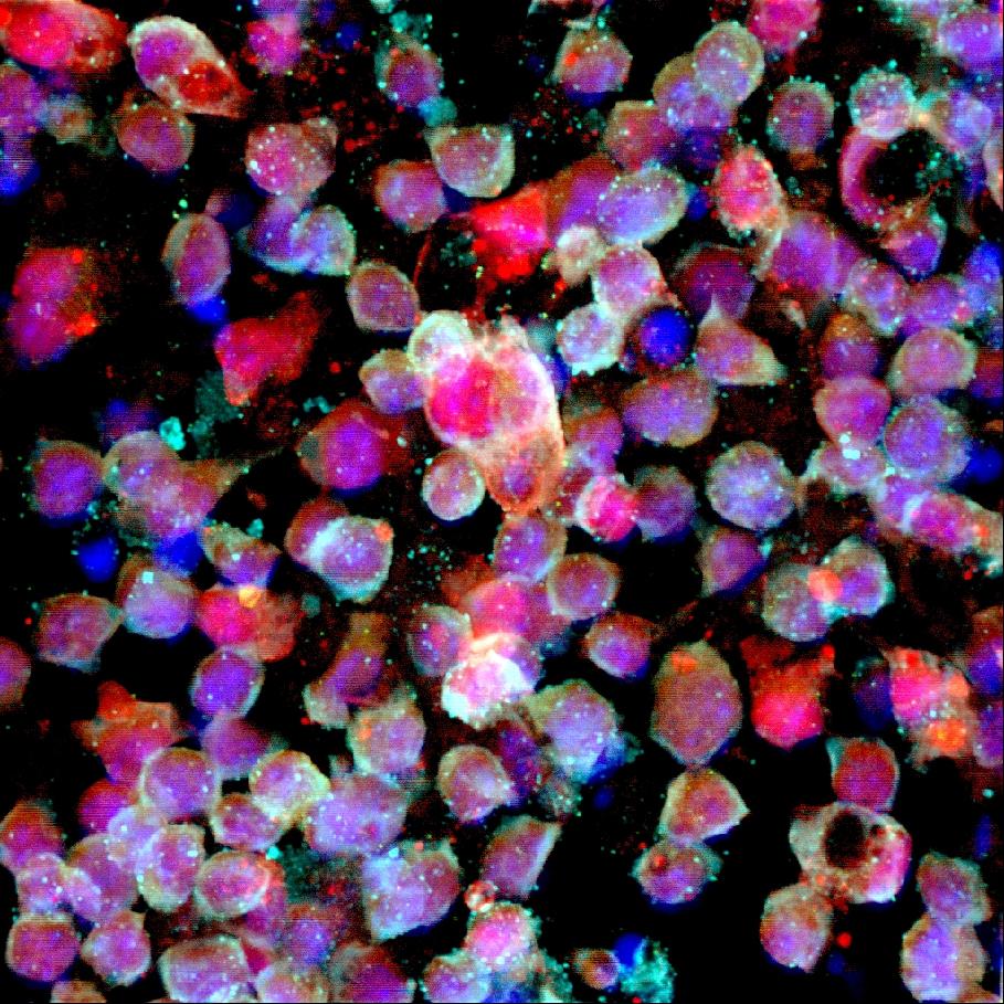 IPS Cells
