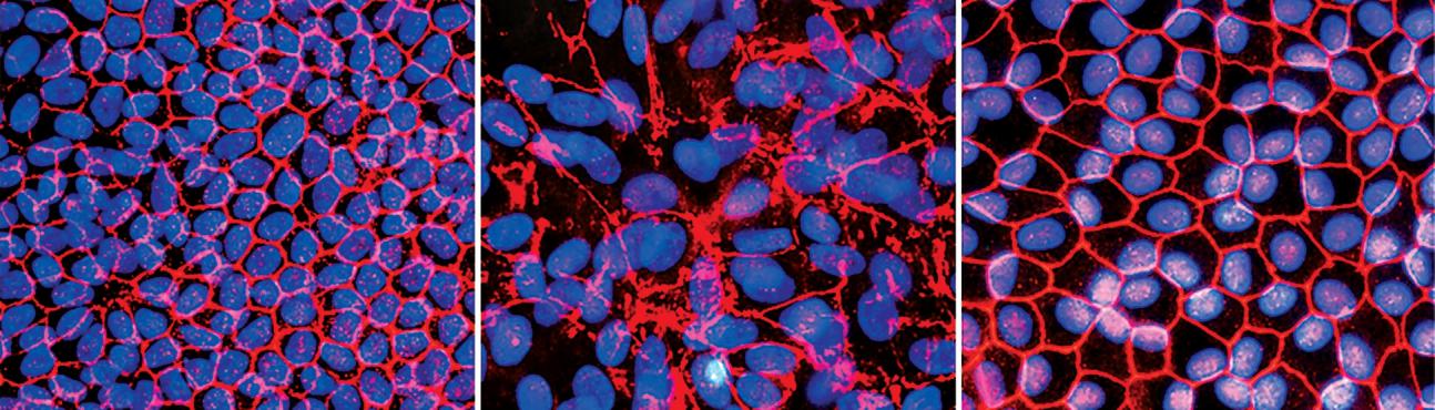 Images of a restored retinal structure