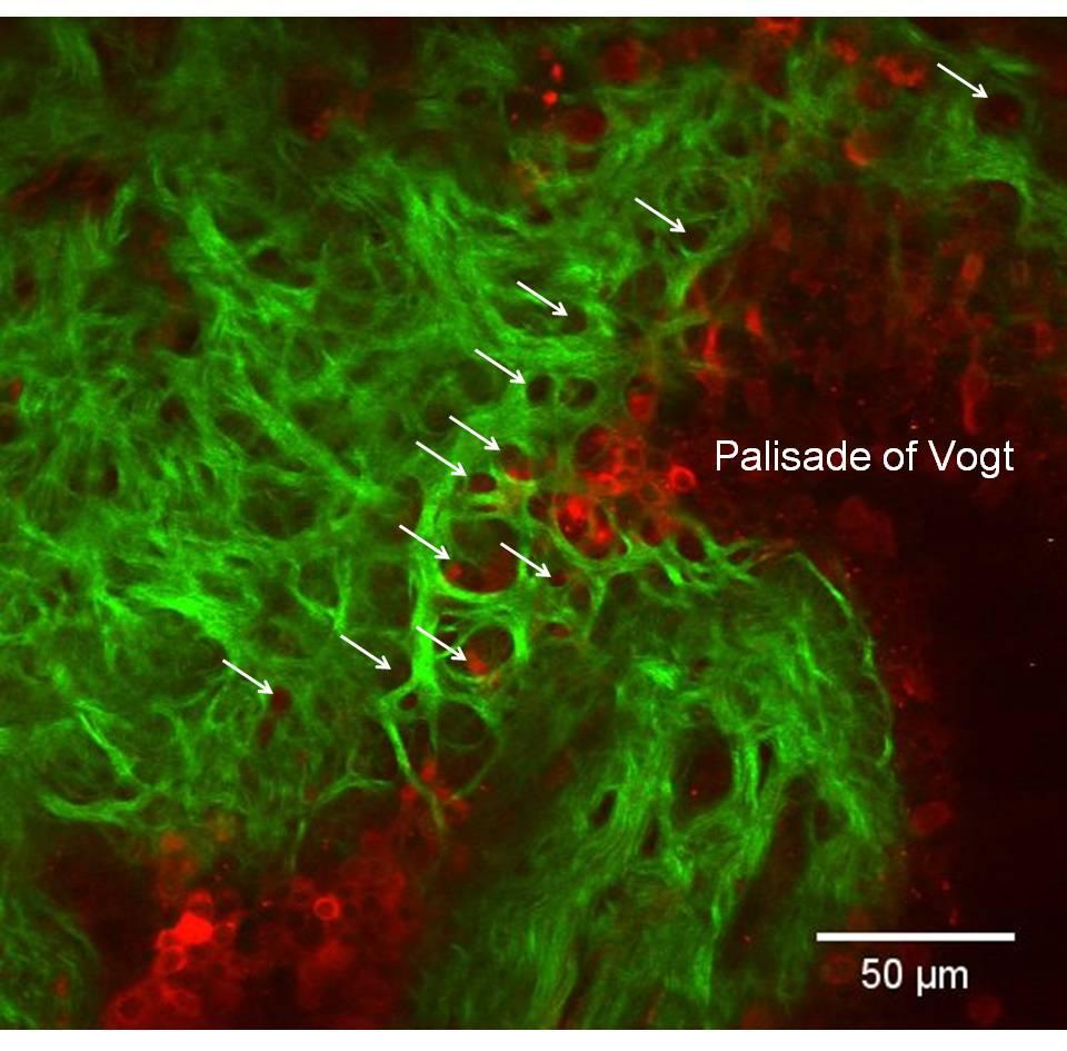 Newly discovered structures within the limbus, the transition zone between the clear cornea and the opaque sclera