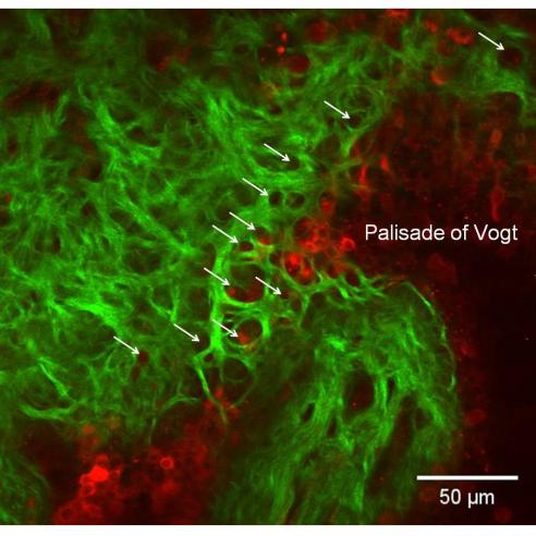 new corneal structure image