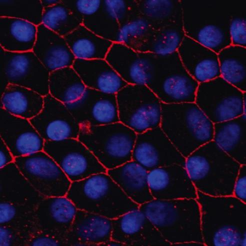 Human induced pluripotent stem cell-retinal pigment epithelium in a dish