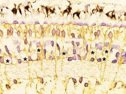 Muller cells