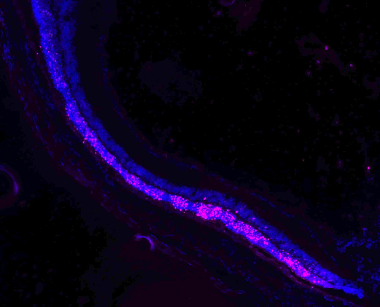 Damaged, untreated retina