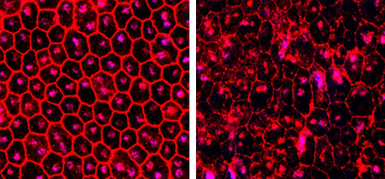 Retinal cells