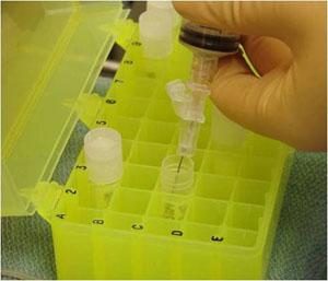 test for ocular melanoma