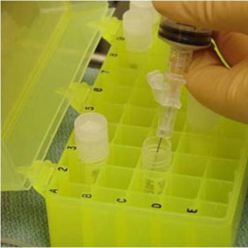 test for ocular melanoma