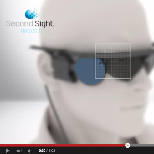 Screenshot of video about the Arugus II Retinal Prosthesis System