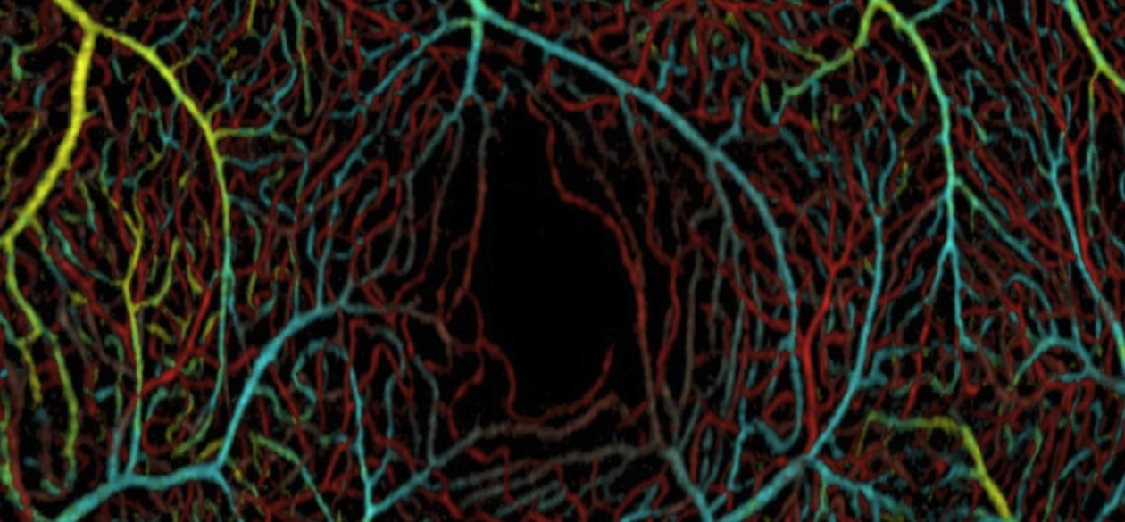 Blood flow in the macula