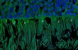 photorecetor cells
