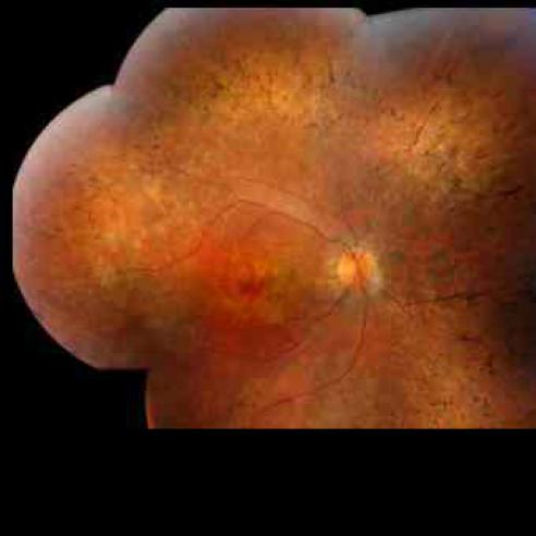 composite of human retina