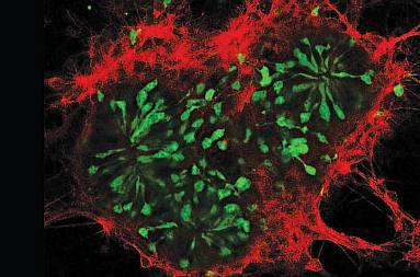 Stained photoreceptor cells and retinal nerve cells
